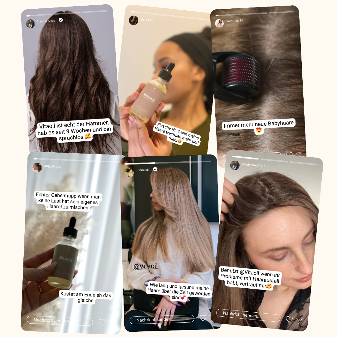 DermaRoller für Haarbildung