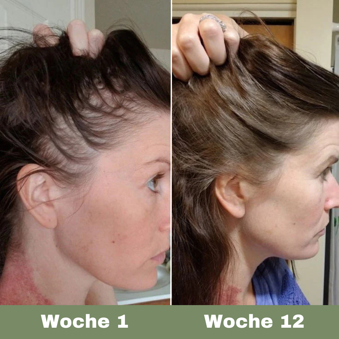 Veganes Haaröl für schnelles Wachstum (black)