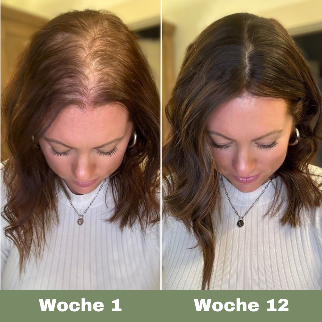 Veganes Haaröl für schnelles Wachstum (black)